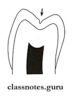 Amalgam Resistance form of tooth provided by flat pulpal and gingval floor