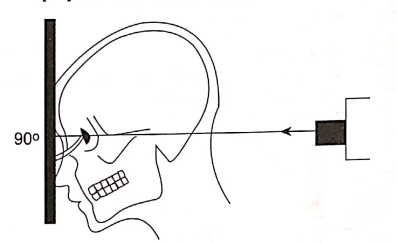 Diagram for the positioning for posteroanterior projection