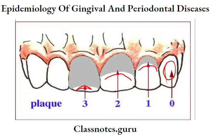 Epidemiology Of Gingival And Periodontal Diseases Plaque Index
