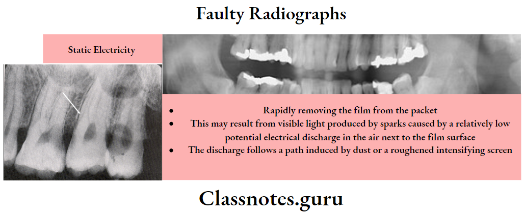 Faulty Radiographs