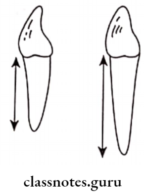 Fixed Partial Denture Teth Longer Roots