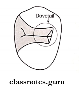 Fundamentals Of Cavity Preparation Dovetail helps in providing retention