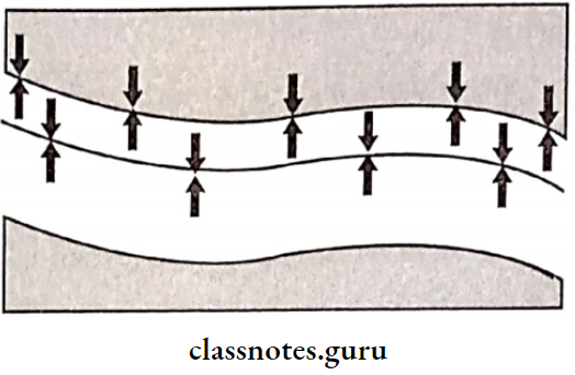 Impression And Mouth Preparation Schematic Representation Of Adhesion