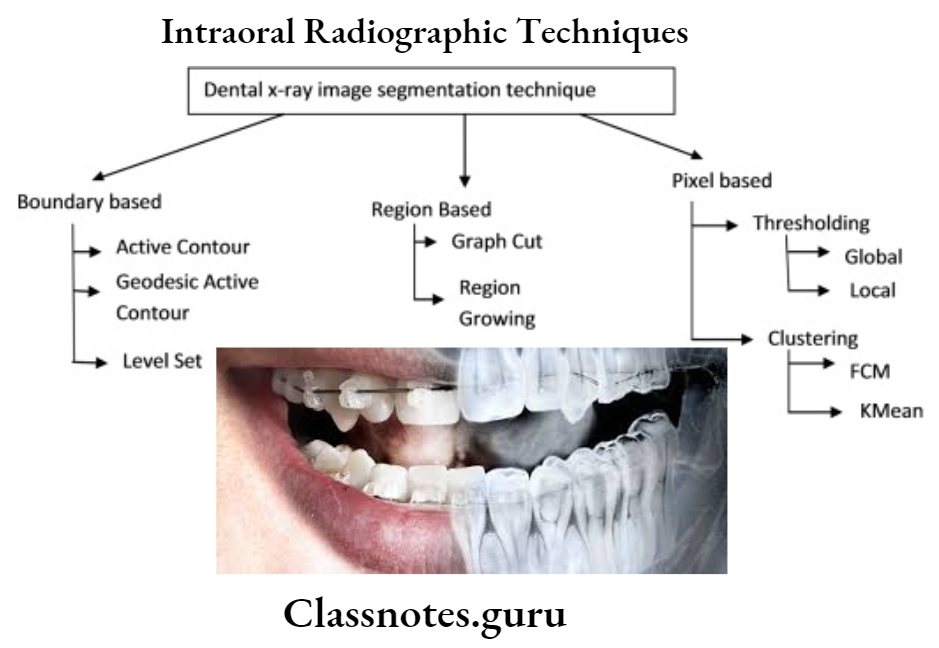 Intraoral Radiographic Techniques.