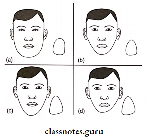 Laboratory Procedures Prior To Try In Facial Form And Tooth Shape