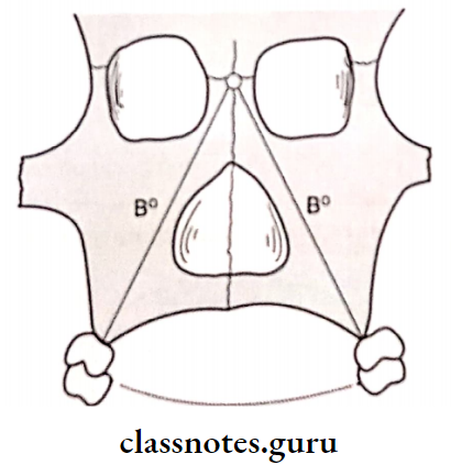 Laboratory Procedures Prior To Try In Spherical Articulator And Glabella