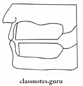 Maxillomandibular Relations Long Essays - Class Notes