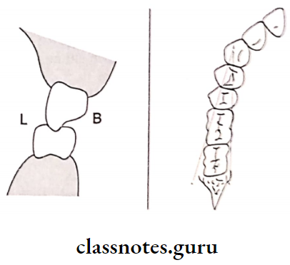 Maxillomandibular Relations Pounds Concept Of Tooth Arrangement