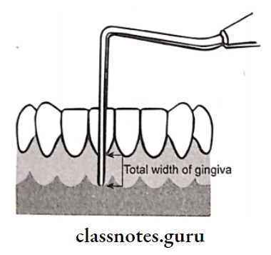 Normal Periodontium Total width of gingiva