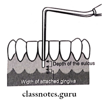 Normal Periodontium width of attached gingiva
