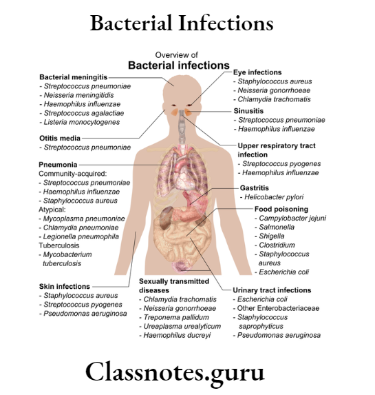 Oral Medicine Bacterial Infections