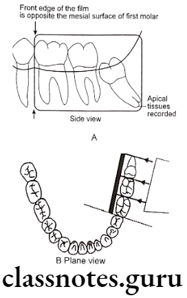 Oral Radiology Intraoral Radiographic Techniques Diagram showing ideal film packet position