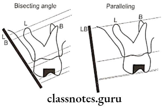 Oral Radiology Intraoral Radiographic Techniques Diagram showing vertical angulations of bisecting angle