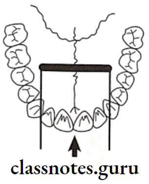 Oral Radiology Intraoral Radiographic Techniques Film placement should be placed at the level of the second premolars