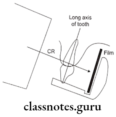 Oral Radiology Intraoral Radiographic Techniques Increased object film distance the film is placed