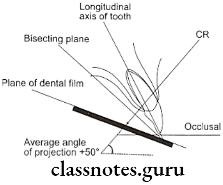 Oral Radiology Intraoral Radiographic Techniques Projection of central ray