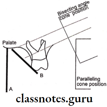 Oral Radiology Intraoral Radiographic Techniques Shallow palate vault