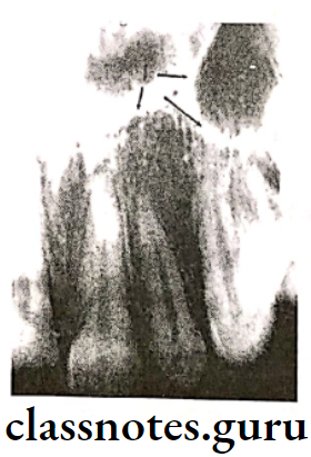 Oral Radiology Normal Anatomic Structures The floor of the nasal fossa