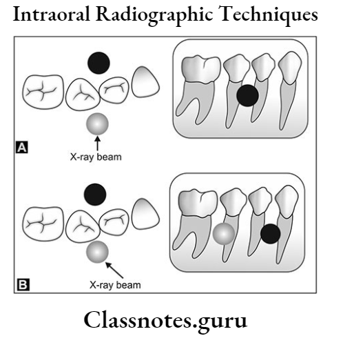 Oral Radiology Object Localized Techniques Buccal and lingual objects shift positions