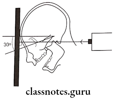 Oral Radiology Specialized Radiographic Techniques Diagram for the positioning of Reverse Townes projection