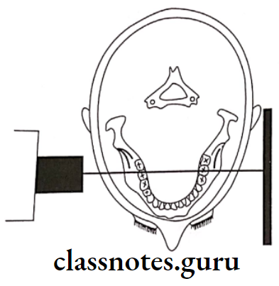Oral Radiology Specialized Radiographic Techniques Diagram for the positioning of lateral oblique projection for ramus