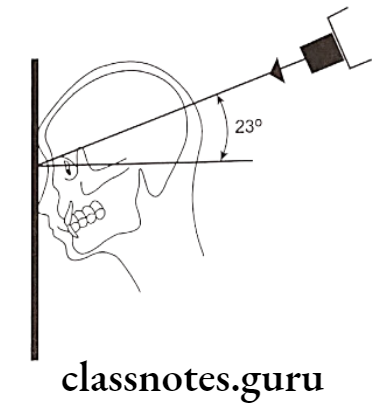 Oral Radiology Specialized Radiographic Techniques Diagram of the positioning inclined posteroanterior projection