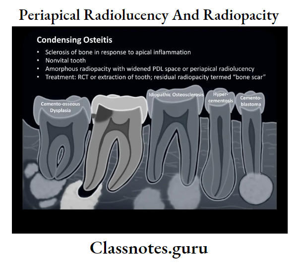Periapical Radiolucency And Radiopacity