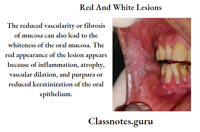 Red And White Lesions.
