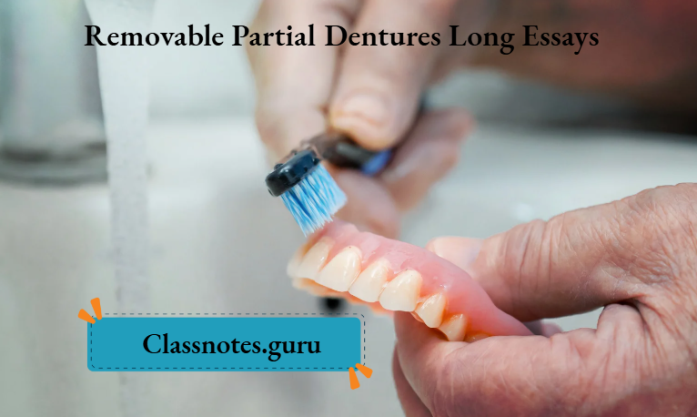 Removable Partial Dentures Long Essays