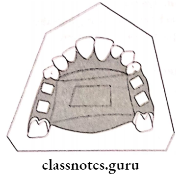 Removable Partial Dentures The Denture Base Area