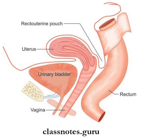 Abdominal Cavity And Peritoneum Rectouterine Pouch