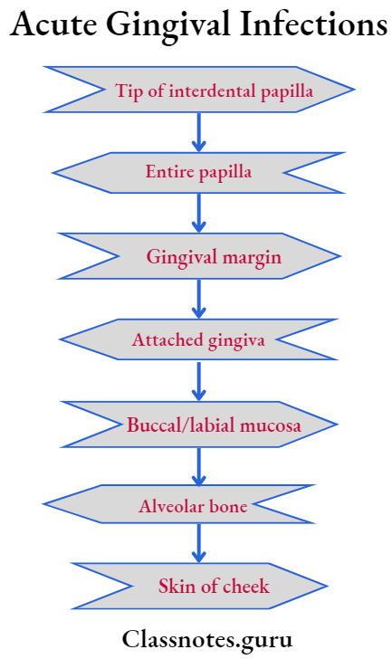 Acute Gingival Infections Stages of progresson