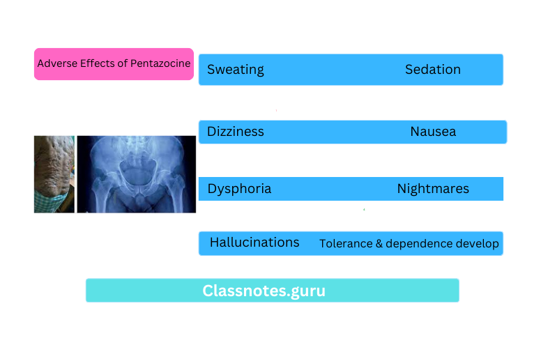 Adverse Effects of Pentazocine