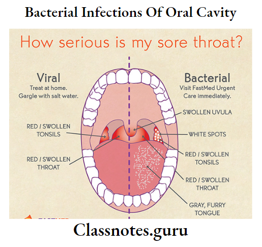 Bacterial Infections Of Oral Cavity