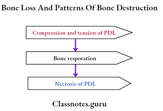 Bone Loss And Patterns Of Bone Destruction Trauma from occlusion