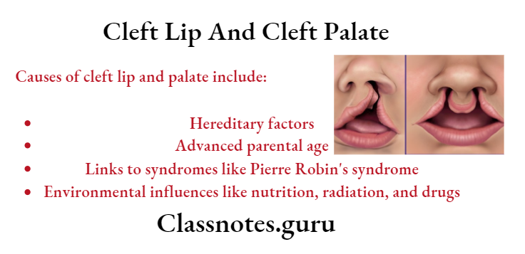 Cleft Lip And Cleft Palate Clef Lip Left And Right