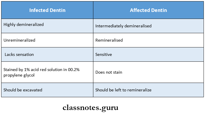 Dental Caries Infected And Affected dentin