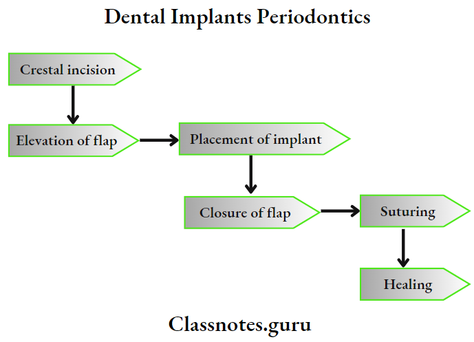 Dental Implants Dental Implants Procedure
