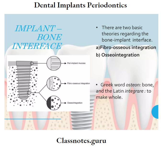 Dental Implantsl Implant Bone Interface