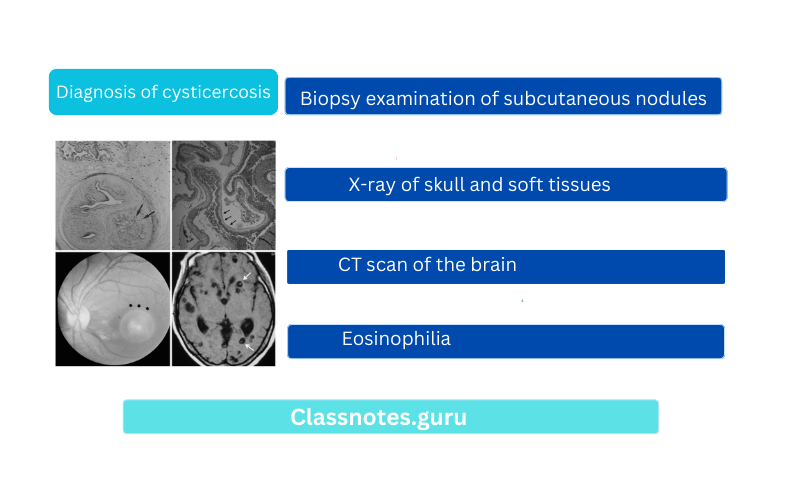 Diagnosis of cysticercosis
