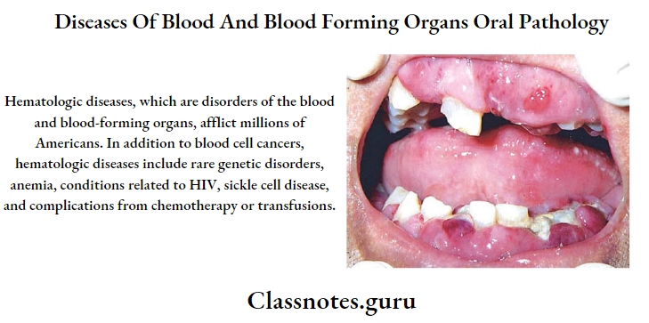 Diseases Of Blood And Blood Forming Organs Oral Pathology