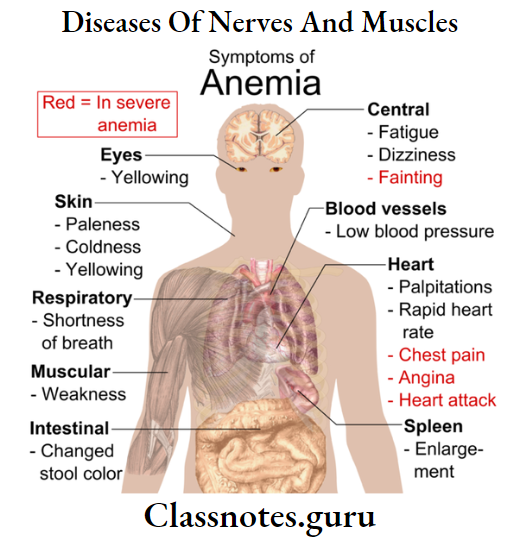Diseases Of Nerves And Muscles