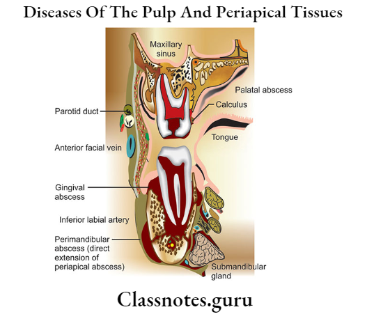 Diseases Of The Pulp And Periapical Tissues