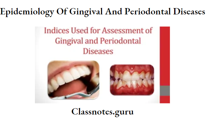 Epidemiology Of Gingival And Periodontal Diseases Of Epidimology