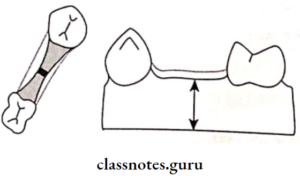 Fixed Partial Denture - Class Notes