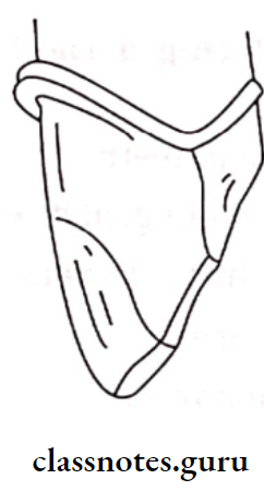 Fixed Partial Denture Features Of An Anterior Metal Ceramic Prepartion