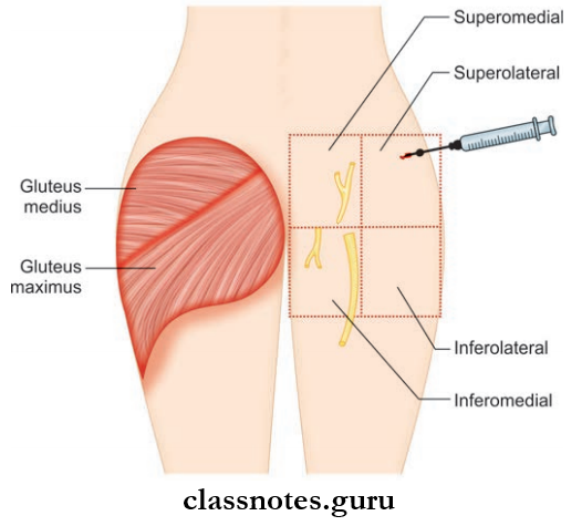 Gluteal Region Safe Quadrant And Site For Intramuscular Injection In Gluteal Region