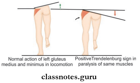 Gluteal Region The Action Of Normal And Paralyzed Gluteus Medius And Minimus Muscles