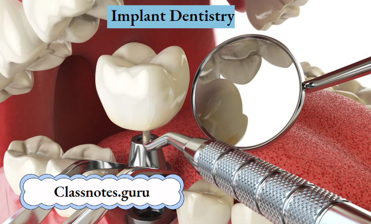 Implant Dentistry