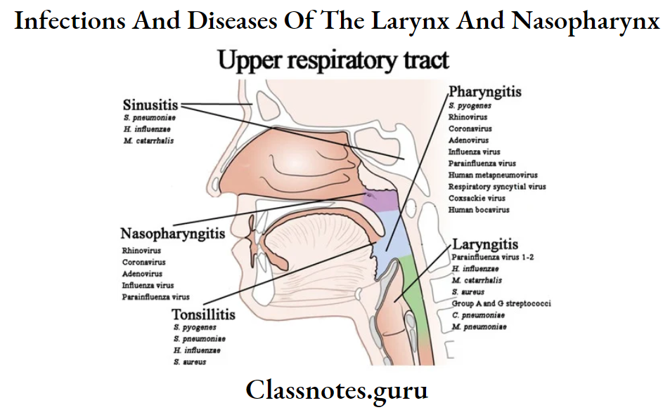 Infections And Diseases Of The Larynx And Nasopharynx Upper respiratory tract